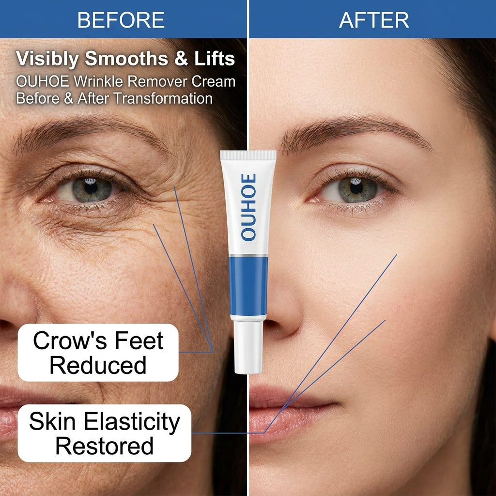 OUHOE Bee Venom Botox Cream – Anti-Aging & Wrinkle Filler for Firm, Glowing Skin | 20g