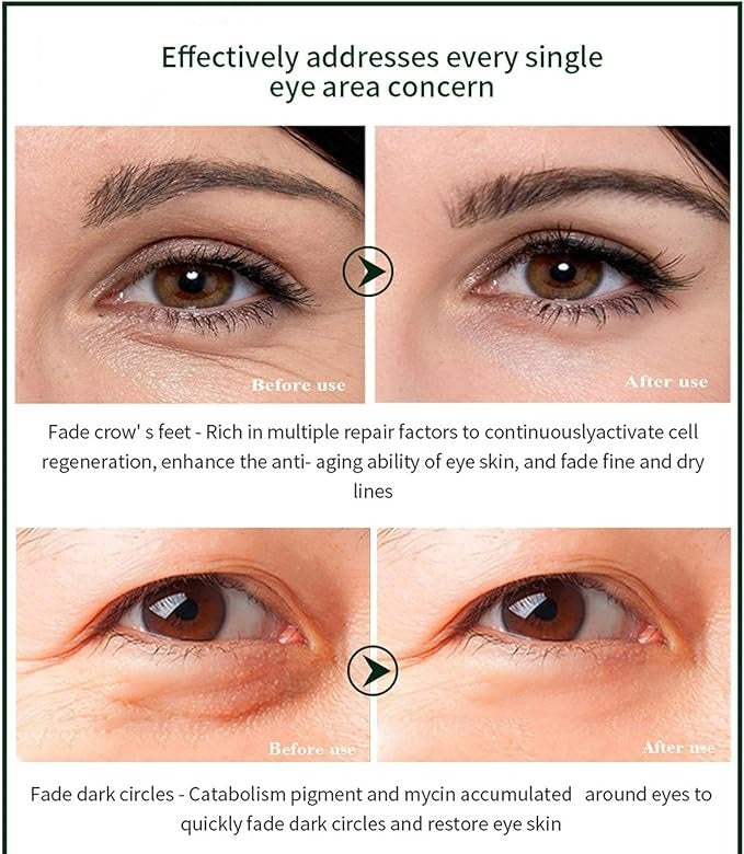 Time Eraser Youth Eye Oil – Lightweight Anti-Aging Treatment for Dark Circles & Fine Lines | 10ml
