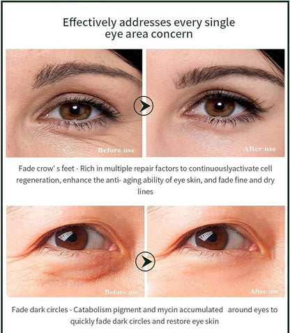 Time Eraser Youth Eye Oil – Lightweight Anti-Aging Treatment for Dark Circles & Fine Lines | 10ml
